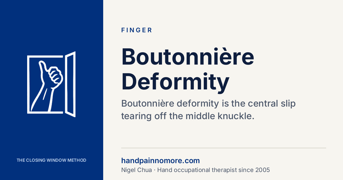 Boutonnière Deformity: The Finger That Bends Later
