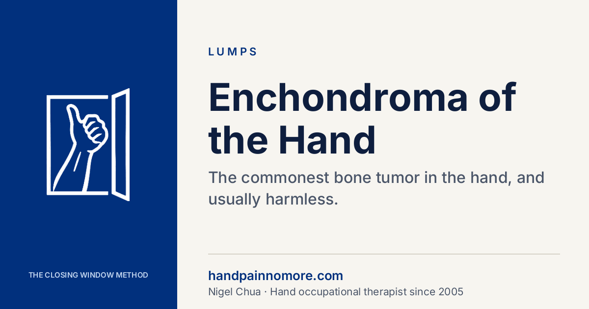 Enchondroma of the Hand: The Hollow in the Bone