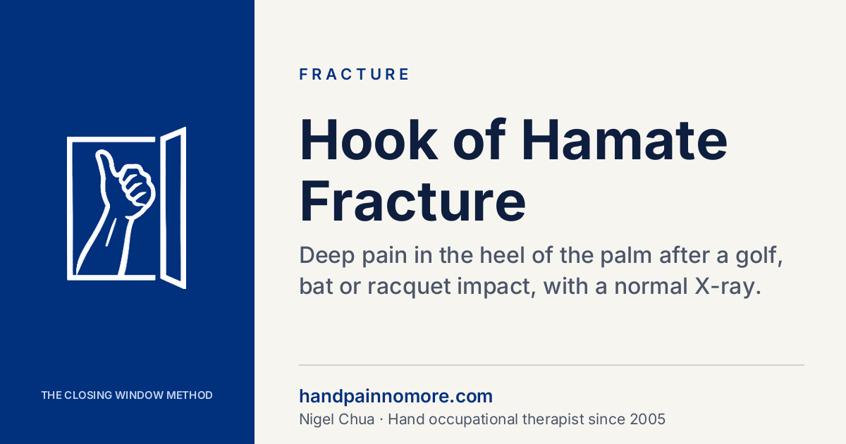 Hook of Hamate Fracture: The Break X-Rays Often Miss