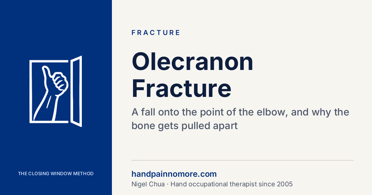 Olecranon Fracture: The Break at the Point of Your Elbow