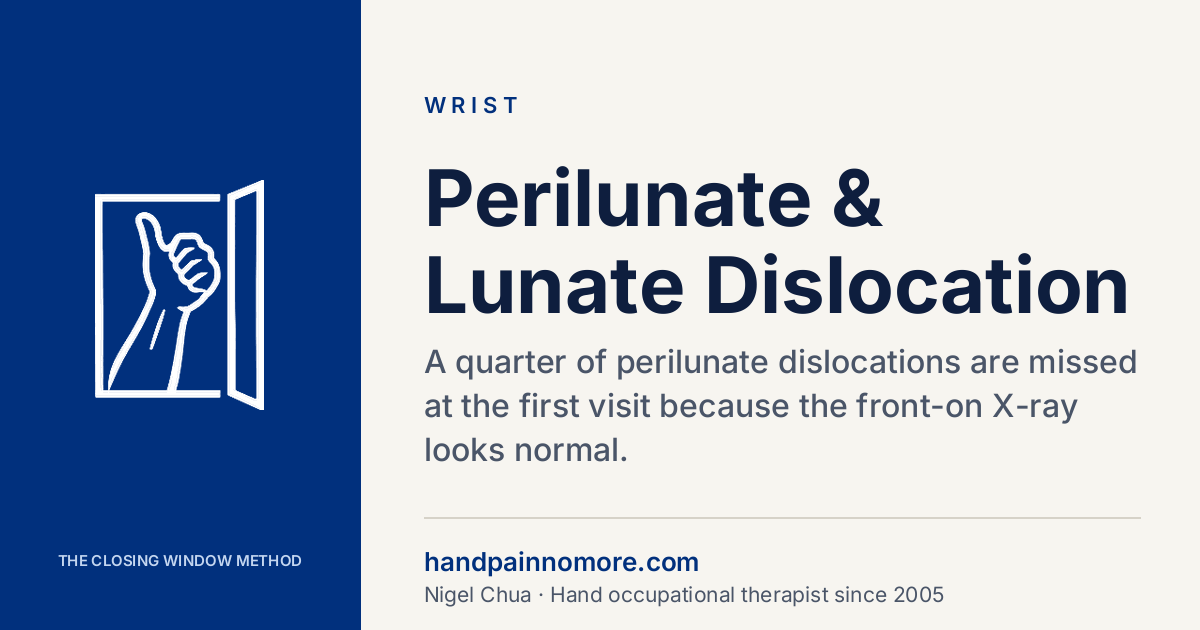 Perilunate and Lunate Dislocation: Often Missed on X-Ray
