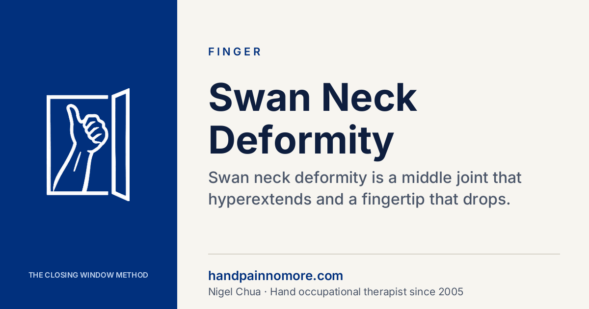 Swan Neck Deformity: Why the Finger Bends Backwards